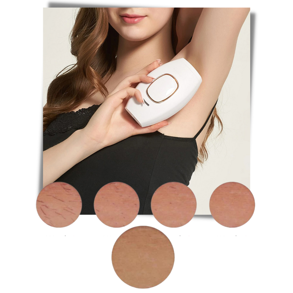 Raxiva - Mini IPL Laser Hair Remover